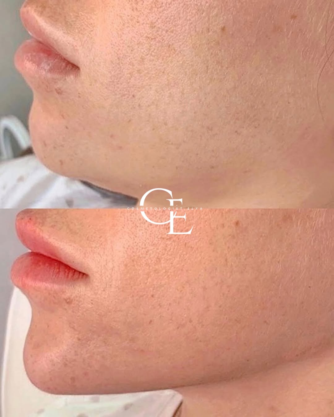 Facial harmonisation